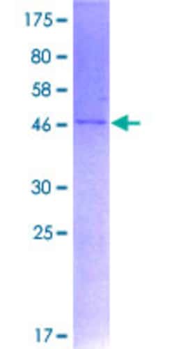 Abnova Human PPIF Full-length ORF (NP_005720.1, 1 a.a. - 207 a.a.) Recombinant Protein with GST-tag at N-terminal 2 &mu;g | Buy Online | Abnova&trade; | Fisher Scientific