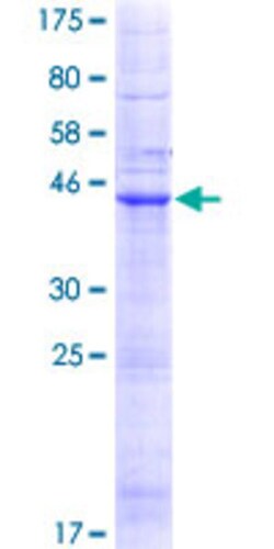 Abnova Human LHFP Full-length ORF (NP_005771.1, 1 a.a. - 200 a.a.) Recombinant Protein with GST-tag at N-terminal 25 &mu;g | Buy Online | Abnova&trade; | Fisher Scientific