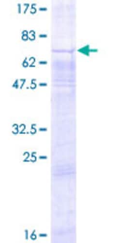 Abnova Human GPR34 Full-length ORF (NP_005291.1, 1 a.a. - 381 a.a.) Recombinant Protein with GST-tag at N-terminal 2 &mu;g | Buy Online | Abnova&trade; | Fisher Scientific