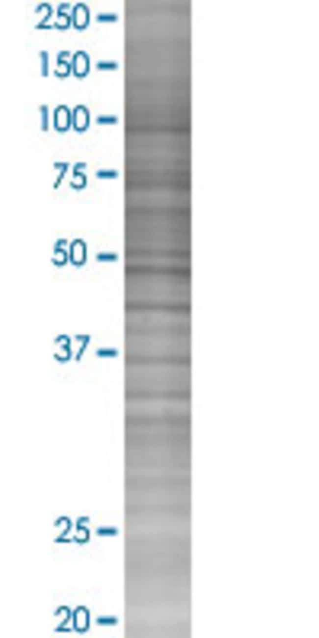 Abnova™ CALCRL 293T Cell Transient Overexpression Lysate (Denatured ...