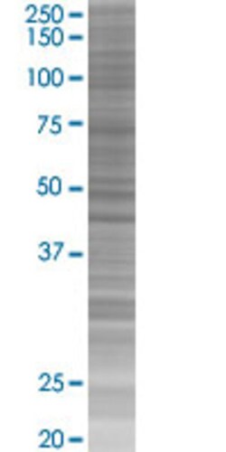 Abnova ANGPTL7 293T Cell Transient Overexpression Lysate (Denatured) (T03) 100 &mu;L | Buy Online | Abnova&trade; | Fisher Scientific