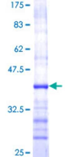 Abnova&trade;&nbsp;Human GZMB Partial ORF (AAH30195, 148 a.a. - 247 a.a.) Recombinant Protein with GST-tag at N-terminal 10&mu;g 