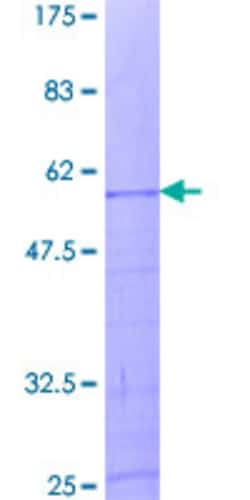 Abnova Human HIST1H1A Full-length ORF (NP_005316.1, 1 a.a. - 215 a.a.) Recombinant Protein with GST-tag at N-terminal 2 &mu;g | Buy Online | Abnova&trade; | Fisher Scientific