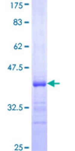 Abnova Human HABP2 Partial ORF (NP_004123, 105 a.a. - 204 a.a.) Recombinant Protein with GST-tag at N-terminal 25 ug | Buy Online | Abnova&trade; | Fisher Scientific