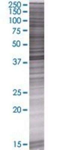 Abnova BCKDK 293T Cell Transient Overexpression Lysate (Denatured) 100 &mu;L | Buy Online | Abnova&trade; | Fisher Scientific