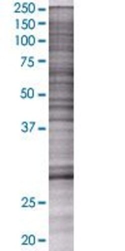 Abnova PCGF3 293T Cell Transient Overexpression Lysate (Denatured) 100 &mu;L | Buy Online | Abnova&trade; | Fisher Scientific