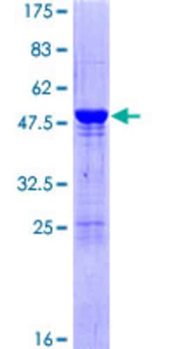 Abnova™ Human HIP2 Full-length ORF (NP_005330.1, 1 a.a. - 200 a.a.) Recombinant Protein with GST-tag at N-terminal
