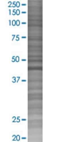 Abnova HNRPD 293T Cell Transient Overexpression Lysate (Denatured) 100 &mu;L | Buy Online | Abnova&trade; | Fisher Scientific