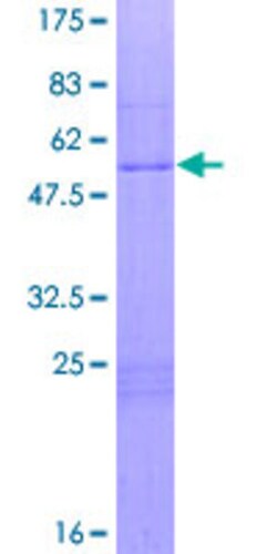 Abnova Human HOXA6 Full-length ORF (NP_076919.1, 1 a.a. - 233 a.a.) Recombinant Protein with GST-tag at N-terminal 2 &mu;g | Buy Online | Abnova&trade; | Fisher Scientific