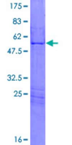 Abnova Human HOXA7 Full-length ORF (NP_008827.2, 1 a.a. - 230 a.a.) Recombinant Protein with GST-tag at N-terminal 2 &mu;g | Buy Online | Abnova&trade; | Fisher Scientific