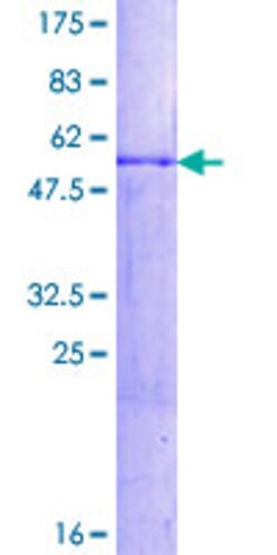 Abnova&trade;&nbsp;Human HES1 Full-length ORF (AAH39152.1, 1 a.a. - 277 a.a.) Recombinant Protein with GST-tag at N-terminal