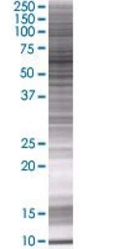 Abnova&trade;&nbsp;HSPD1 293T Cell Transient Overexpression Lysate (Denatured) (T01)