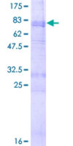 Abnova Human HTR2B Full-length ORF (NP_000858.2, 1 a.a. - 481 a.a.) Recombinant Protein with GST-tag at N-terminal 2 &mu;g | Buy Online | Abnova&trade; | Fisher Scientific