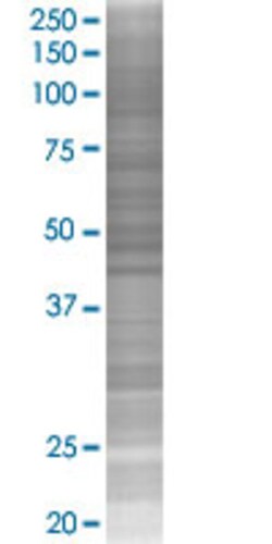 Abnova CFI 293T Cell Transient Overexpression Lysate (Denatured) 100 &mu;l | Buy Online | Abnova&trade; | Fisher Scientific