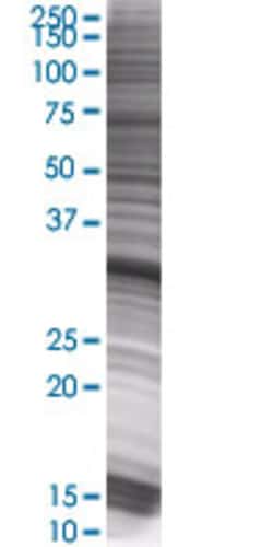 Abnova IFI35 293T Cell Transient Overexpression Lysate (Denatured) 100 &mu;L | Buy Online | Abnova&trade; | Fisher Scientific