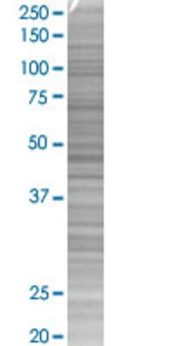 Abnova&trade;&nbsp;IL1RN 293T Cell Transient Overexpression Lysate (Denatured) (T01)