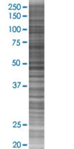 Abnova IL3 293T Cell Transient Overexpression Lysate (Denatured) (T01) 100 &mu;l | Buy Online | Abnova&trade; | Fisher Scientific