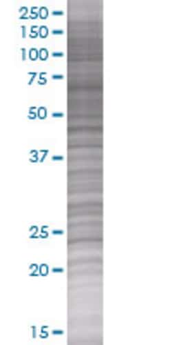 Abnova IL6 293T Cell Transient Overexpression Lysate (Denatured) 100 &mu;L | Buy Online | Abnova&trade; | Fisher Scientific