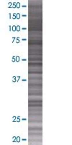 Abnova IL15 293T Cell Transient Overexpression Lysate (Denatured) 100 &mu;L | Buy Online | Abnova&trade; | Fisher Scientific