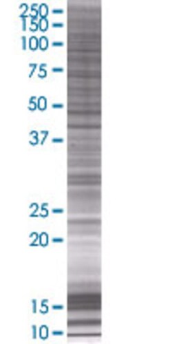 Abnova ITPKB 293T Cell Transient Overexpression Lysate (Denatured) 100 &mu;L | Buy Online | Abnova&trade; | Fisher Scientific