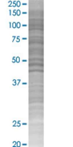 Abnova&trade;&nbsp;KIR3DL1 293T Cell Transient Overexpression Lysate (Denatured)