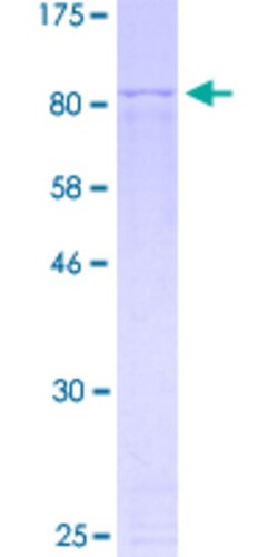Abnova Human KRT9 Full-length ORF (AAI67813.1, 1 a.a. - 623 a.a.) Recombinant Protein with GST-tag at N-terminal 2 &mu;g | Buy Online | Abnova&trade; | Fisher Scientific