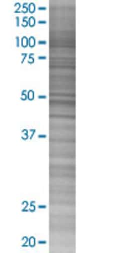 Abnova LCAT 293T Cell Transient Overexpression Lysate (Denatured) 100 &mu;L | Buy Online | Abnova&trade; | Fisher Scientific