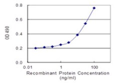 LGALS3 (Human) Matched Antibody Pair, Polyclonal , Abnova™