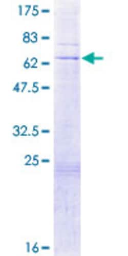 Abnova Human LIG3 Full-length ORF (AAH09026.1, 1 a.a. - 299 a.a.) Recombinant Protein with GST-tag at N-terminal 2 &mu;g | Buy Online | Abnova&trade; | Fisher Scientific