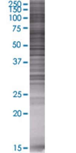 Abnova&trade;&nbsp;FADS1 293T Cell Transient Overexpression Lysate (Denatured)