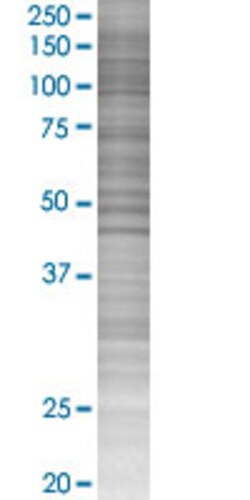 Abnova&trade;&nbsp;LYN 293T Cell Transient Overexpression Lysate (Denatured) (T02)