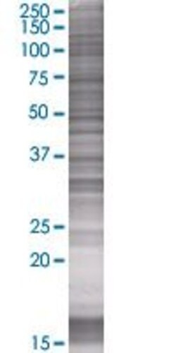 Abnova&trade;&nbsp;MFNG 293T Cell Transient Overexpression Lysate (Denatured)