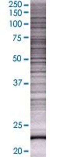 Abnova MGMT 293T Cell Transient Overexpression Lysate (Denatured) 100 &mu;L | Buy Online | Abnova&trade; | Fisher Scientific