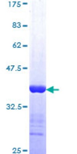 Abnova Human MSR1 Partial ORF (NP_619729, 121 a.a. - 220 a.a.) Recombinant
