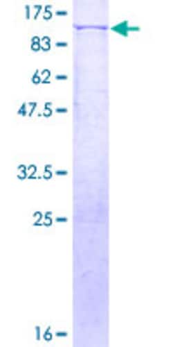 Abnova Human MYB Full-length ORF (NP_005366.2, 1 a.a. - 640 a.a.) Recombinant Protein with GST-tag at N-terminal 2 &mu;g | Buy Online | Abnova&trade; | Fisher Scientific