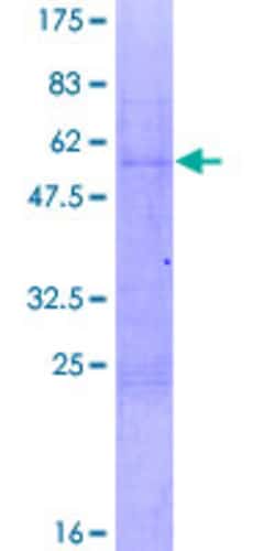 Abnova Human NAB2 Full-length ORF (AAH07756.1, 1 a.a. - 241 a.a.) Recombinant Protein with GST-tag at N-terminal 2 &mu;g | Buy Online | Abnova&trade; | Fisher Scientific