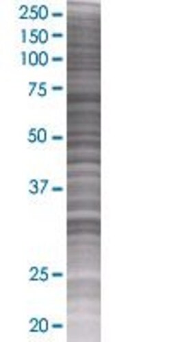 Abnova NACA 293T Cell Transient Overexpression Lysate (Denatured) 100 &mu;L | Buy Online | Abnova&trade; | Fisher Scientific
