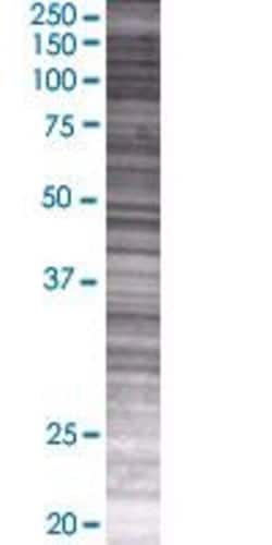 Abnova NUBP1 293T Cell Transient Overexpression Lysate (Denatured) 100&mu;L | Buy Online | Abnova&trade; | Fisher Scientific