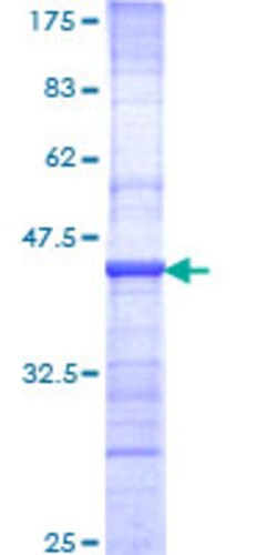 Abnova Human NBN Partial ORF (NP_002476, 645 a.a. - 754 a.a.) Recombinant