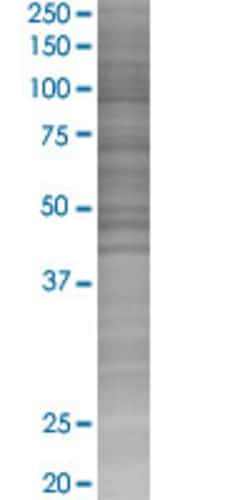Abnova NDUFS3 293T Cell Transient Overexpression Lysate (Denatured) (T02) 100 &mu;L | Buy Online | Abnova&trade; | Fisher Scientific