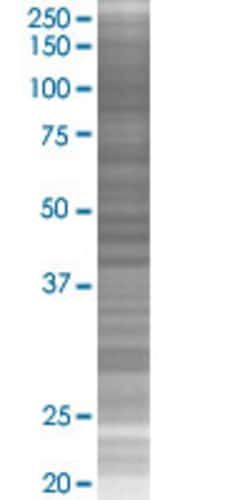 Abnova NDUFS5 293T Cell Transient Overexpression Lysate (Denatured) 100 &mu;L | Buy Online | Abnova&trade; | Fisher Scientific