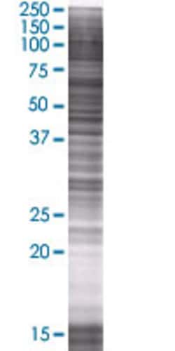 Abnova NDUFS6 293T Cell Transient Overexpression Lysate (Denatured) 100 &mu;L | Buy Online | Abnova&trade; | Fisher Scientific