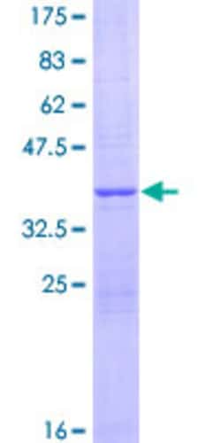 Abnova Human NDUFV3 Full-length ORF (NP_001001503.1, 1 a.a. - 108 a.a.) Recombinant Protein with GST-tag at N-terminal 25 ug | Buy Online | Abnova&trade; | Fisher Scientific