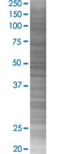 Abnova RPL10A 293T Cell Transient Overexpression Lysate (Denatured) 100 &mu;L | Buy Online | Abnova&trade; | Fisher Scientific