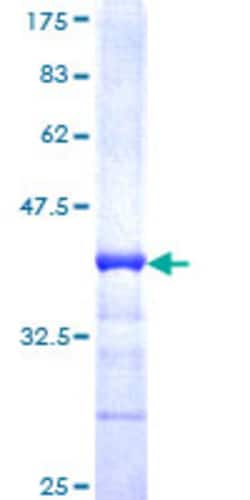 Abnova Human NRD1 Partial ORF (NP_002516, 1058 a.a. - 1156 a.a.) Recombinant