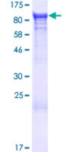 Abnova Human NSF Full-length ORF (AAH30613.1, 1 a.a. - 744 a.a.) Recombinant Protein with GST-tag at N-terminal 25 ug | Buy Online | Abnova&trade; | Fisher Scientific