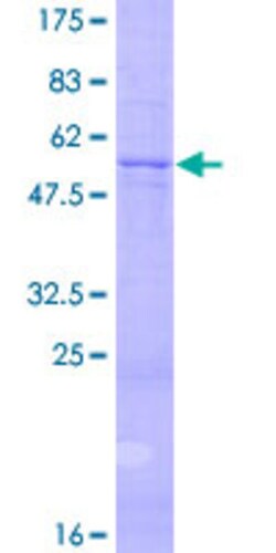 Abnova Human NTF3 Full-length ORF (NP_002518.1, 1 a.a. - 257 a.a.) Recombinant Protein with GST-tag at N-terminal 10&mu;g | Buy Online | Abnova&trade; | Fisher Scientific