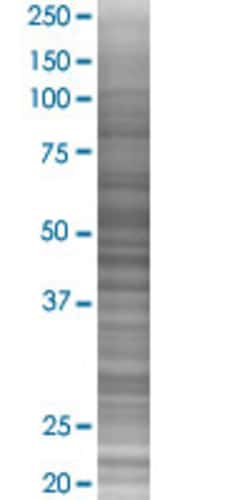 Abnova NUCB1 293T Cell Transient Overexpression Lysate (Denatured) (T02) 100&mu;L | Buy Online | Abnova&trade; | Fisher Scientific