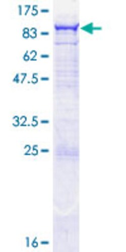 Abnova Human OAS2 Full-length ORF (NP_002526.2, 1 a.a. - 687 a.a.) Recombinant
