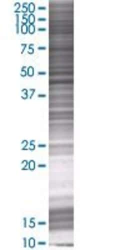 Abnova OR2C1 293T Cell Transient Overexpression Lysate (Denatured) 100 &mu;L | Buy Online | Abnova&trade; | Fisher Scientific